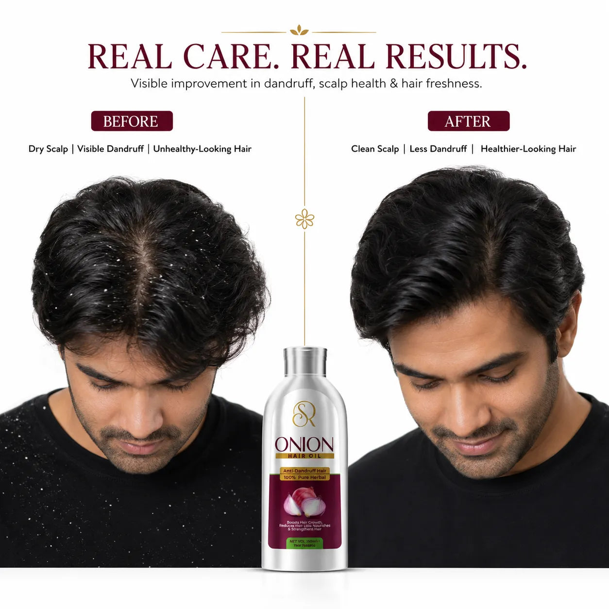 Onion Hair Oil