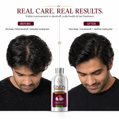 Onion Hair Oil