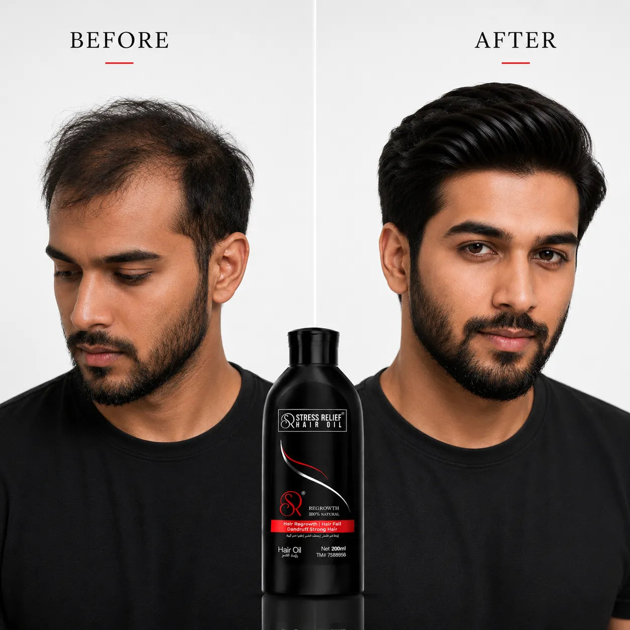 Stress Relief Hair Oil